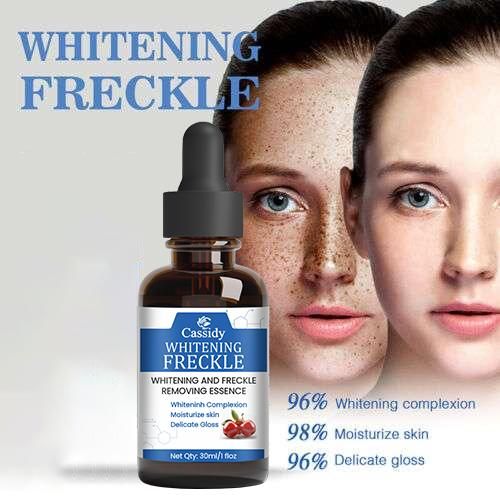 CASSIDY Whitening Frenkle Removal Serum, 30ml (Pack Of 2)